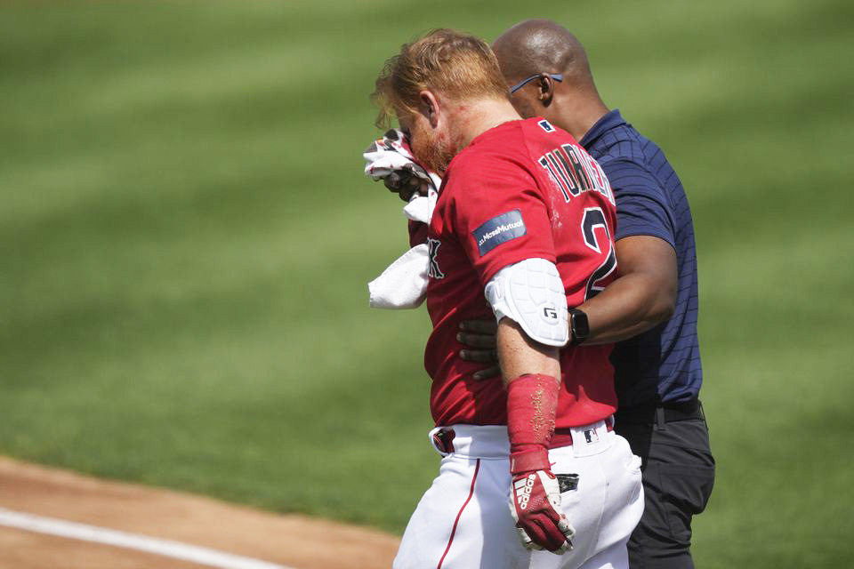 Así quedó el rostro de Justin Turner después de recibir un pelotazo en el spring training