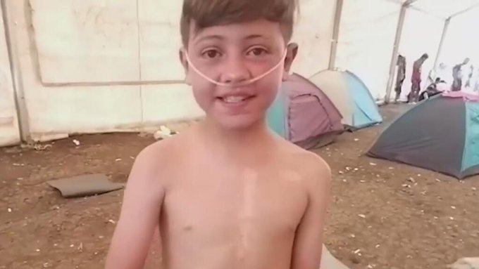 Meiker, el niño venezolano que cruzó el Darién y montó la Bestia con un tanque de oxígeno: llegó a EEUU por un trasplante de corazón (+ videos)