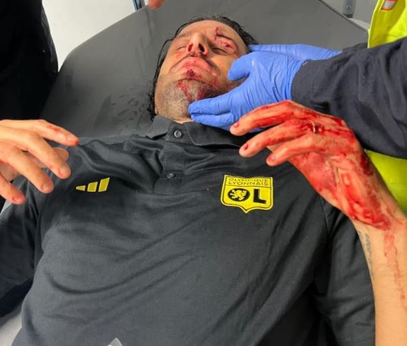 Fabio Grosso sufre grave lesión tras un ataque al autobús del Lyon