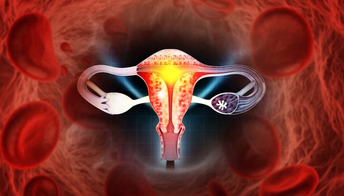 Científicos afirman que la IA podría aportar un mejor análisis de sangre para el cáncer de ovario