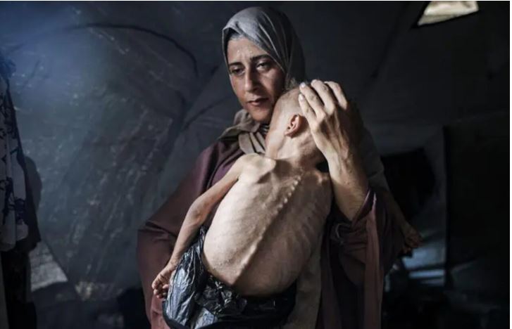 La historia de la foto de Hedaya y su bebé, una de las imágenes más impactantes de la hambruna en Gaza
