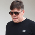 Cantante de Andy y Lucas se hizo una rinoplastia y se le desformó la nariz por no cuidarse