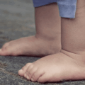 Murió niña de 2 años tras ser arrollada por su padre en Lara