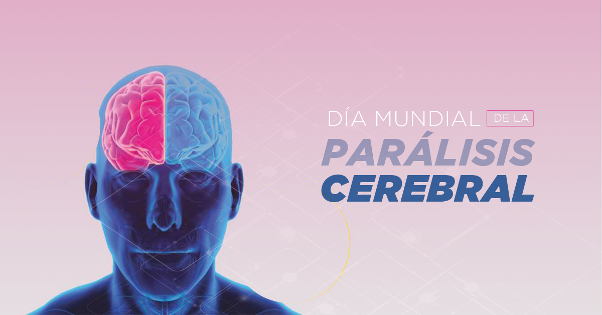 Hoy se conmemora el día mundial de la Parálisis cerebral
