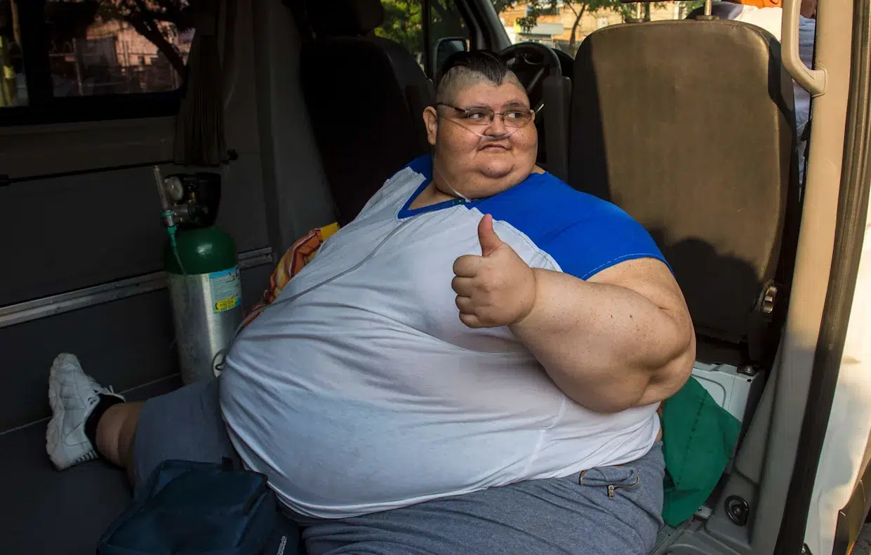 Falleció Juan Pedro Franco, el hombre más obeso del mundo